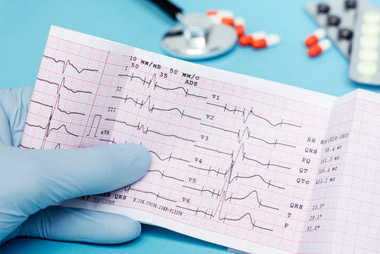 Taller De Electrocardiografía Avanzada | Sociedad Argentina De Medicina ...